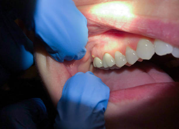 Best Dentist for Dental Trauma  in Darmstadt, IN