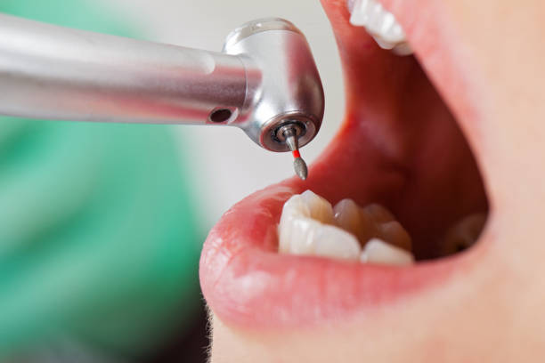 Best Dentist for Severe Toothache  in Darmstadt, IN